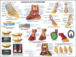 Navicular Anatomy